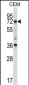 RORC Antibody (Center)