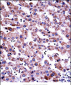 GDI2 Antibody (Center)