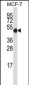 GDI2 Antibody (Center)