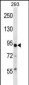 TRIM36 Antibody (Center)