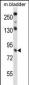 TRIM36 Antibody (Center)