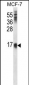 LY6E Antibody (Center)