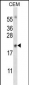 MYOG Antibody (N-term)