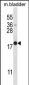 MYOG Antibody (N-term)