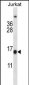 BCL2 Antibody (Center)