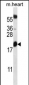 BCL2 Antibody (Center)