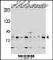 DCBLD2 Antibody (C-term)