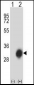 HLA-DPB1 Antibody (Center)