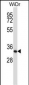 XPA Antibody (C-term)