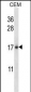 IL21 Antibody (C-term)