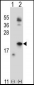 IL21 Antibody (C-term)