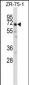 POU2F2 Antibody (N-term)