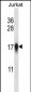 CENPA Antibody (Center)