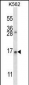 AGR2 Antibody (N-term)