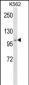 ADAMTS5 Antibody (N-term)