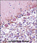 RARA Antibody (C-term)