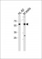 RARA Antibody (C-term)