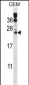 RAB6B Antibody (C-term)