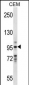 VAV1 Antibody (Center)