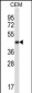 BMP2 Antibody (Center)