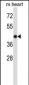 BMP7 Antibody (C-term)