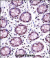 TERF2 Antibody (Center)