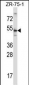 TERF2 Antibody (Center)