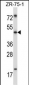 MDM4 Antibody (Center)