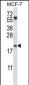 PYCARD Antibody (C-term)