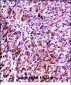 VAMP7 Antibody (Center)