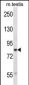 CUL4A Antibody (N-term)