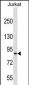 CUL4A Antibody (N-term)