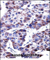 DUSP9 Antibody (C-term)