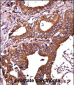 RIPK1 Antibody (N-term)