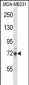 RIPK1 Antibody (N-term)