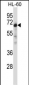 NRBP1 Antibody (N-term)