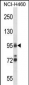 TOP1 Antibody (N-term)