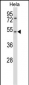 CHRNA7 Antibody (N-term)