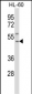 TACR1 Antibody (Center)