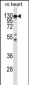 Mouse Csf1r Antibody (C-term)