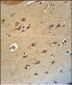 DLG4 Antibody (C-term) (Rat) (Ascites)