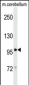 DLG4 Antibody (C-term) (Rat) (Ascites)