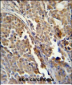 ALDH3A2 Antibody (Ascites)