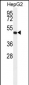 ALDH3A2 Antibody (Ascites)