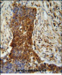 MMP2 Antibody (Ascites)