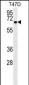 MMP2 Antibody (Ascites)