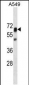 PTPN11 Antibody