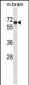 PTPN11 Antibody