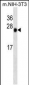 CSNK2B Antibody