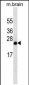 RAB8A Antibody